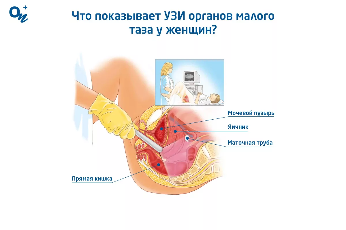 Как называется узи женских органов