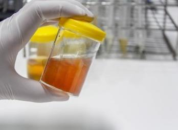 Моча оранжевого цвета у ребенка