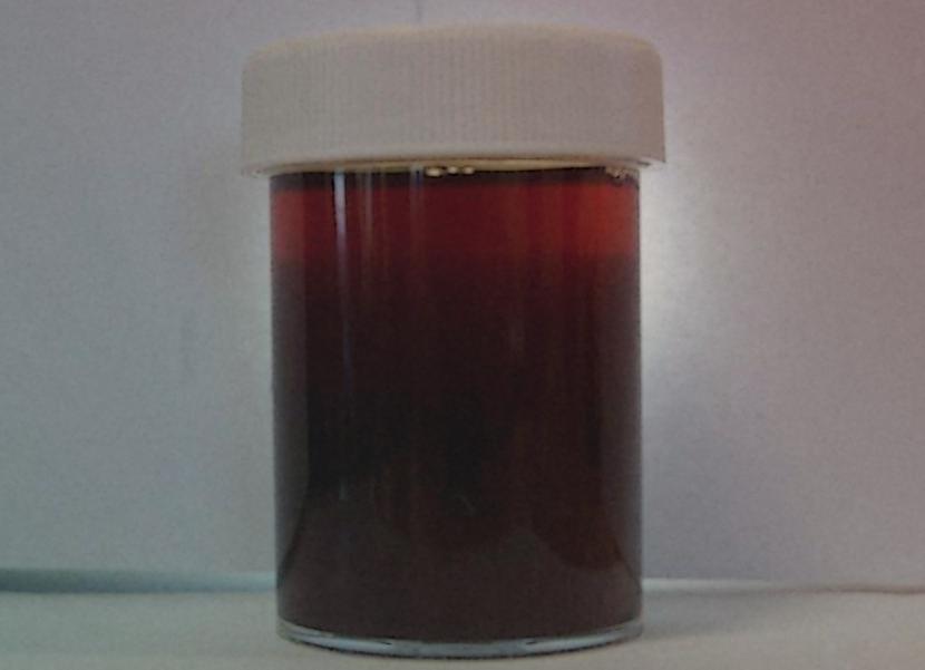 Моча черного цвета причины Моча черного цвета причины