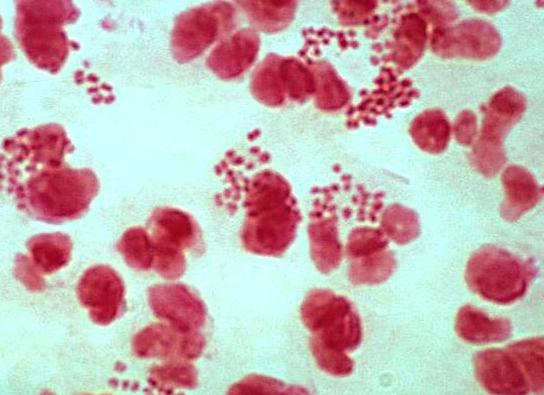 Микроскопия мазка из уретры у мужчин