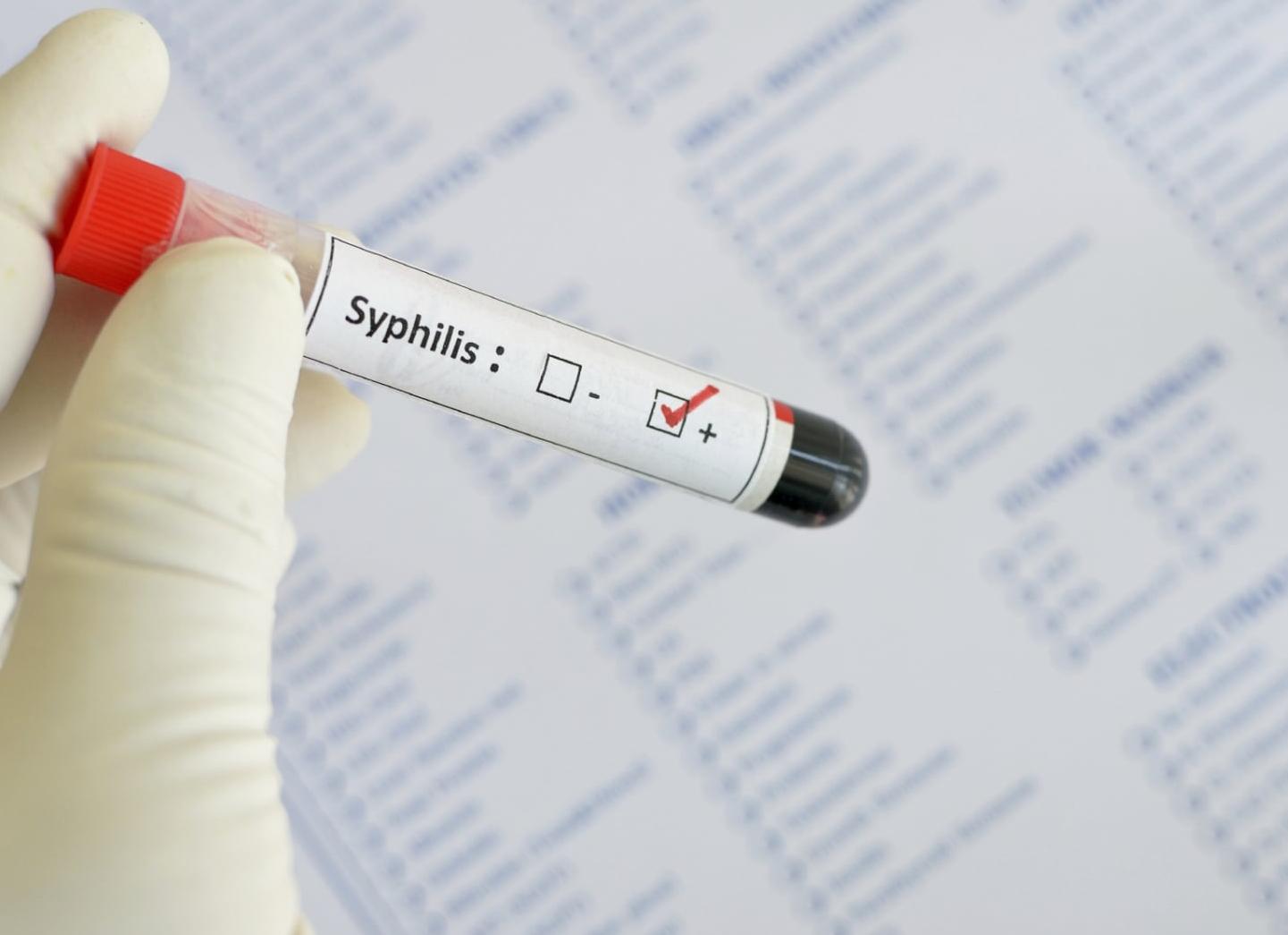 Кровь на орс