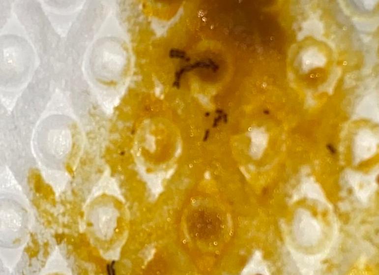 Капельки крови в кале у грудничка