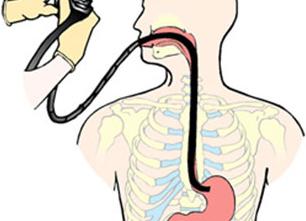 Как проверяют желудок