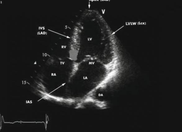 Как подготовиться к узи сердца взрослому