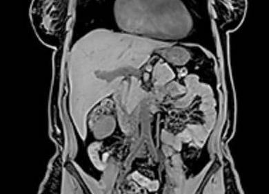 Как лучше проверить кишечник мрт или колоноскопия