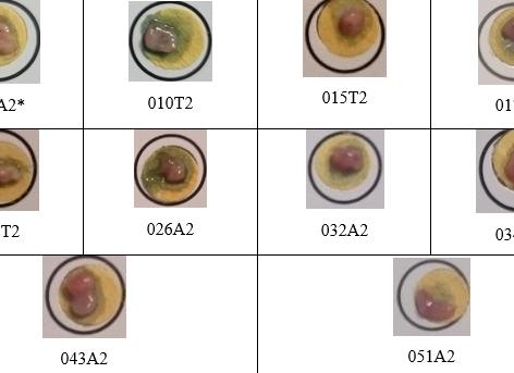 Хеликобактер тест положительный