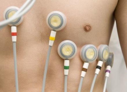 Экг как правильно делать