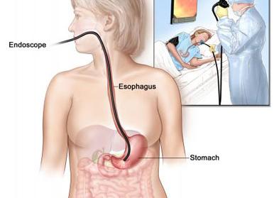 Эдгс что это