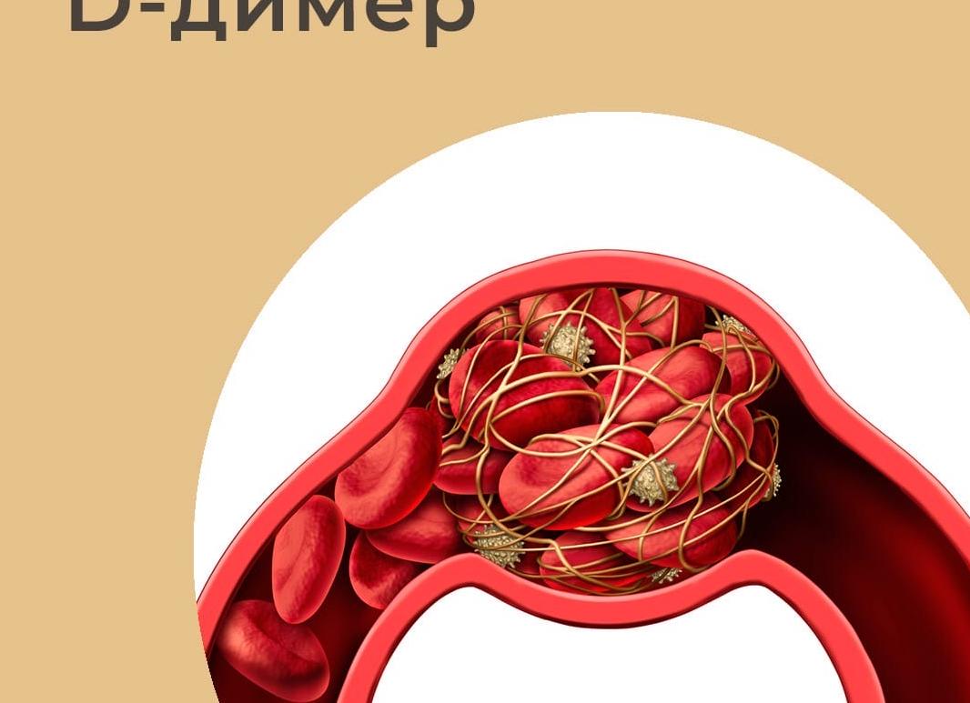 Дедимер что это такое Дедимер что это такое