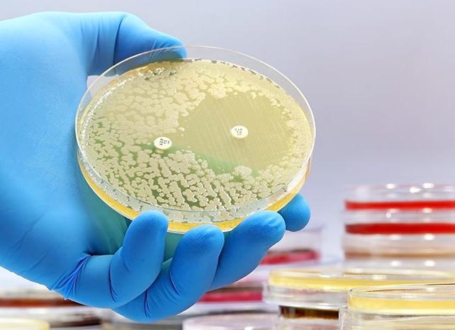 Чем лечить бактерии в моче у женщин