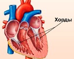 Малая аномалия развития сердца дополнительная хорда левого желудочка