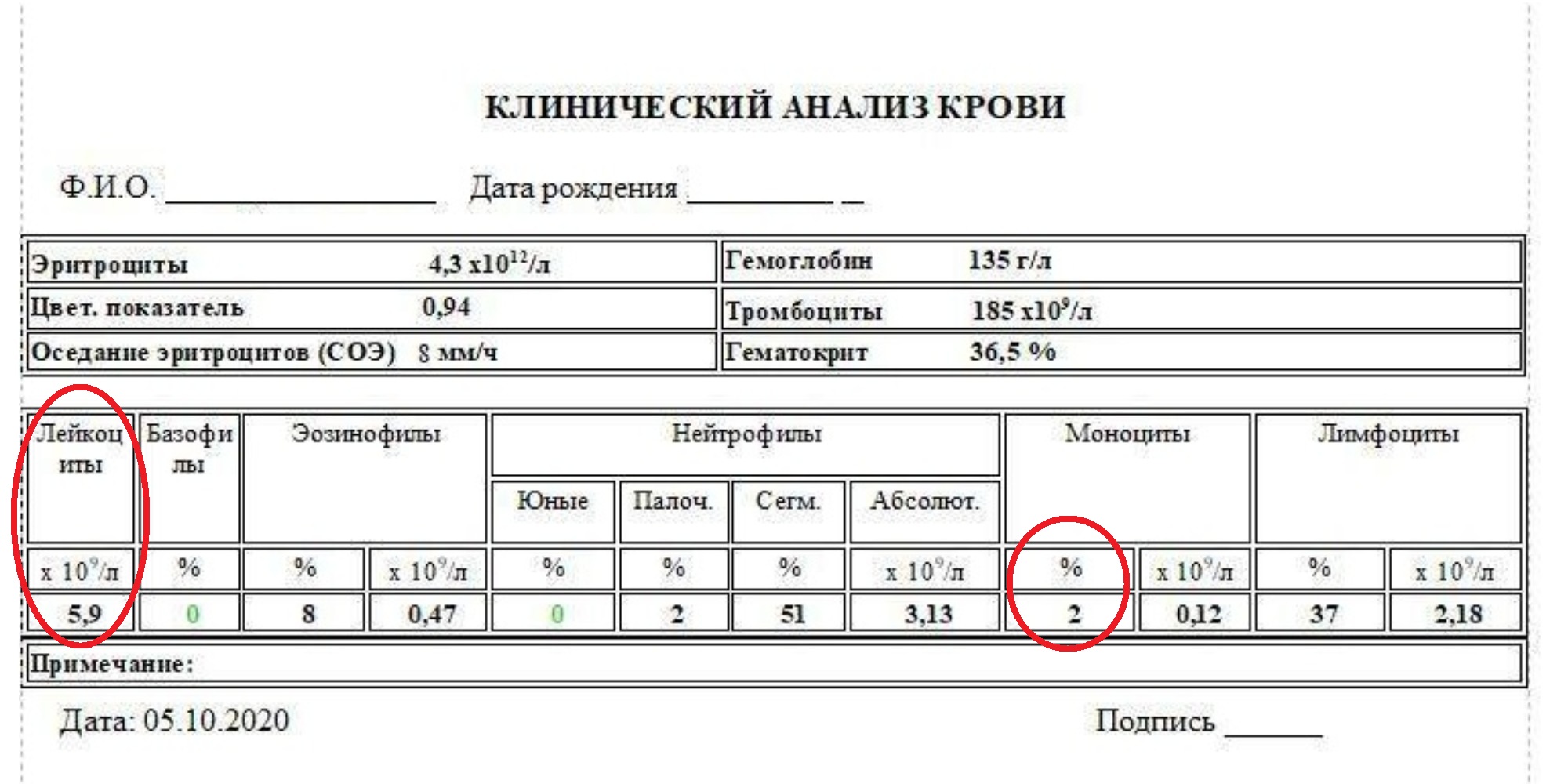 Моноциты в крови завышены у ребенка