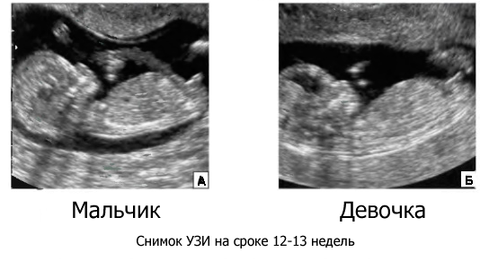 Можно ли на 13 неделе узнать пол ребенка