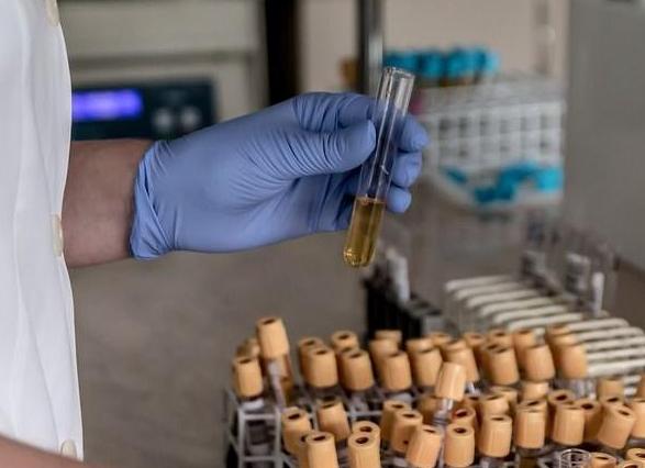 Моча белого цвета почему