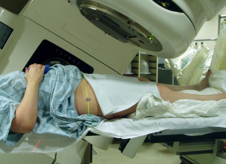 Лучевая терапия как проходит
