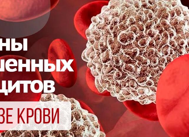 Лейкоциты в крови повышены у женщины