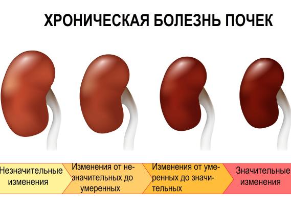 Диффузное поражение почек
