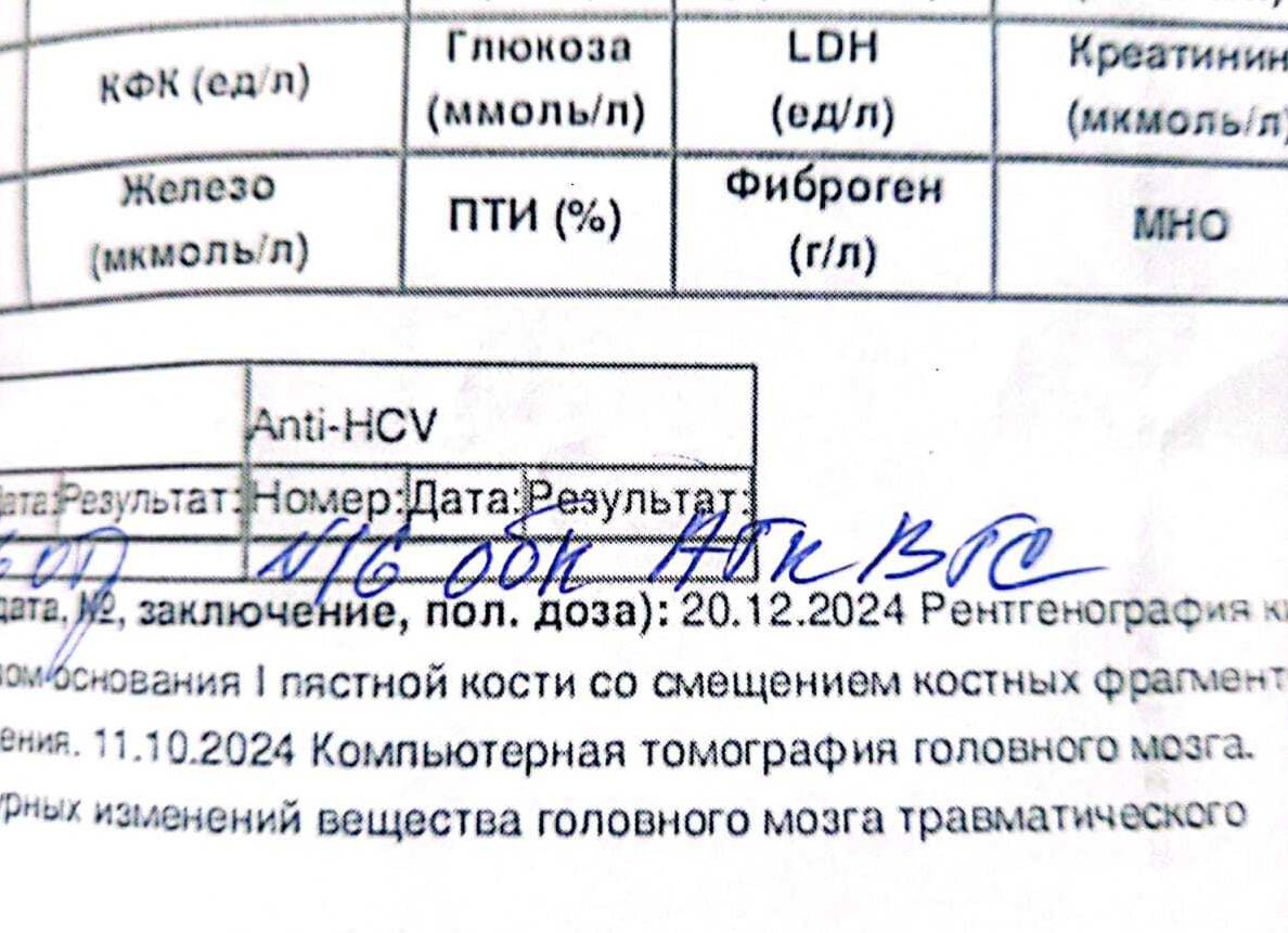 Анализ крови на гепатит расшифровка у взрослых норма в таблице