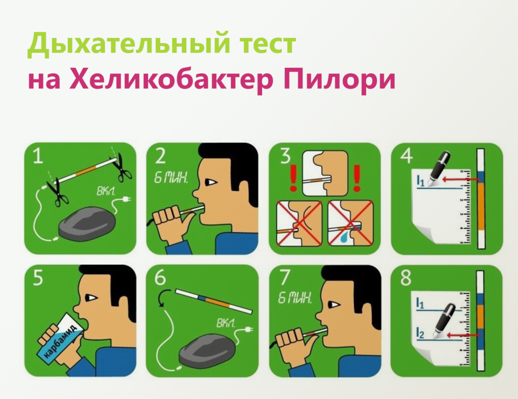 Как делают анализ на хеликобактер