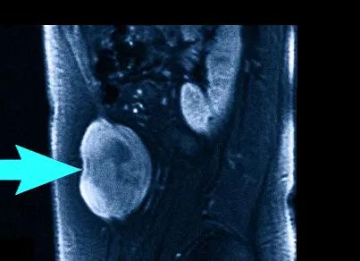 Мрт мягких тканей живота что показывает