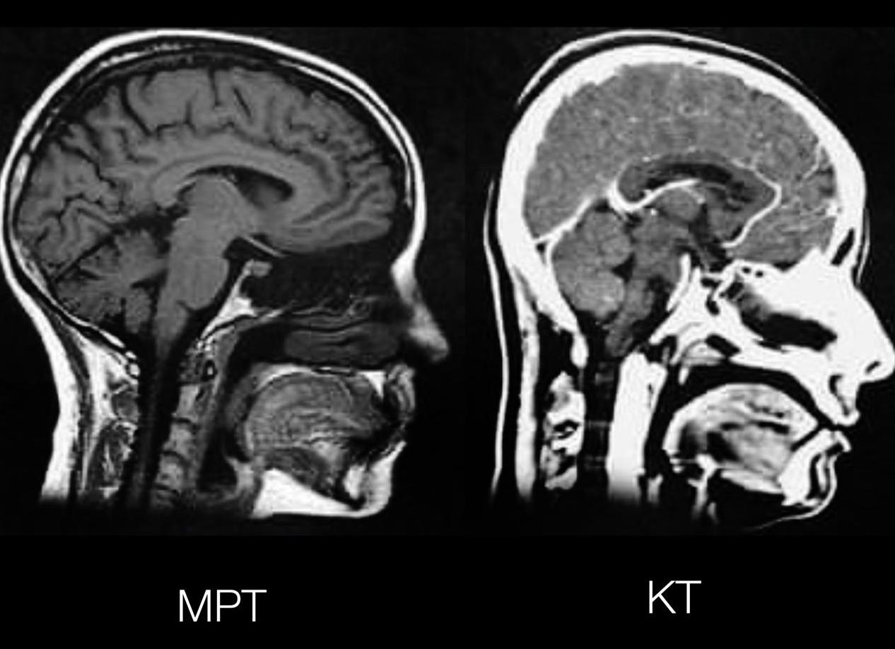 Мрт и кт в чем разница головного мозга Мрт и кт в чем разница головного мозга