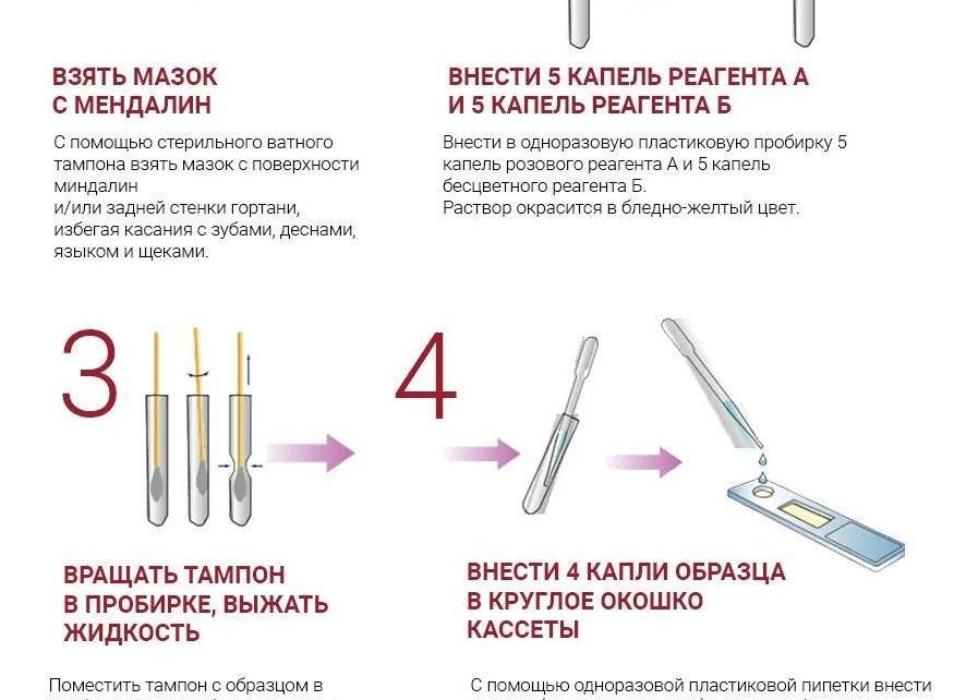 Мазок из зева на стрептококк