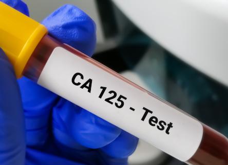 Какой онкомаркер показывает рак молочной железы