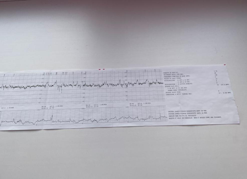Как расшевелить ребенка на ктг