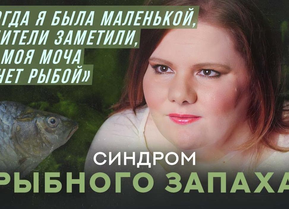 Если моча пахнет рыбой что это