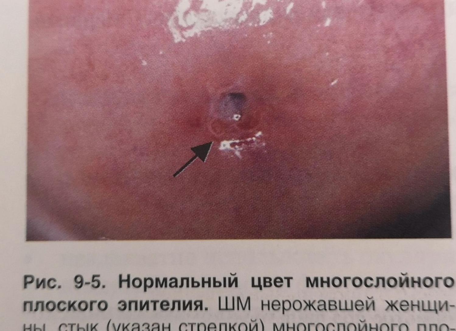 Эпителий что это такое у женщин