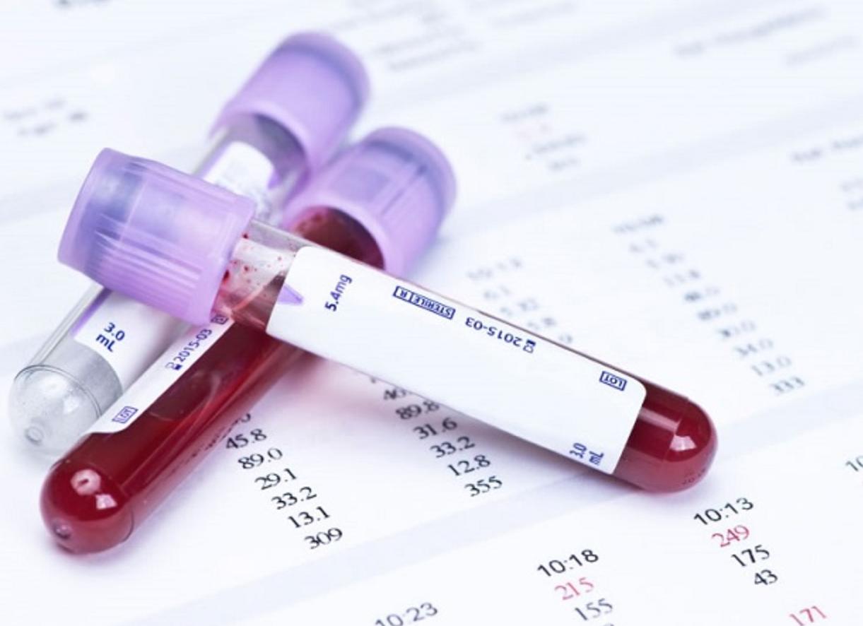 Что такое ифа