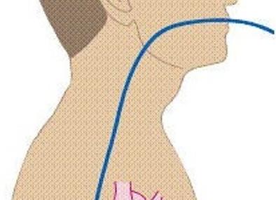 Чп эфи что это