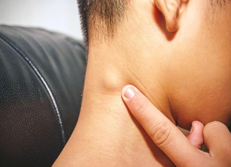 Липома на шее что это такое фото Липома на шее что это такое фото