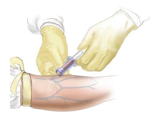 Кровь из пальца натощак сдавать или нет