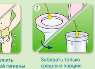 Как собрать анализ по нечипоренко