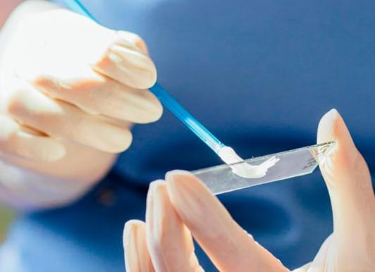 Как подготовиться мазок на флору