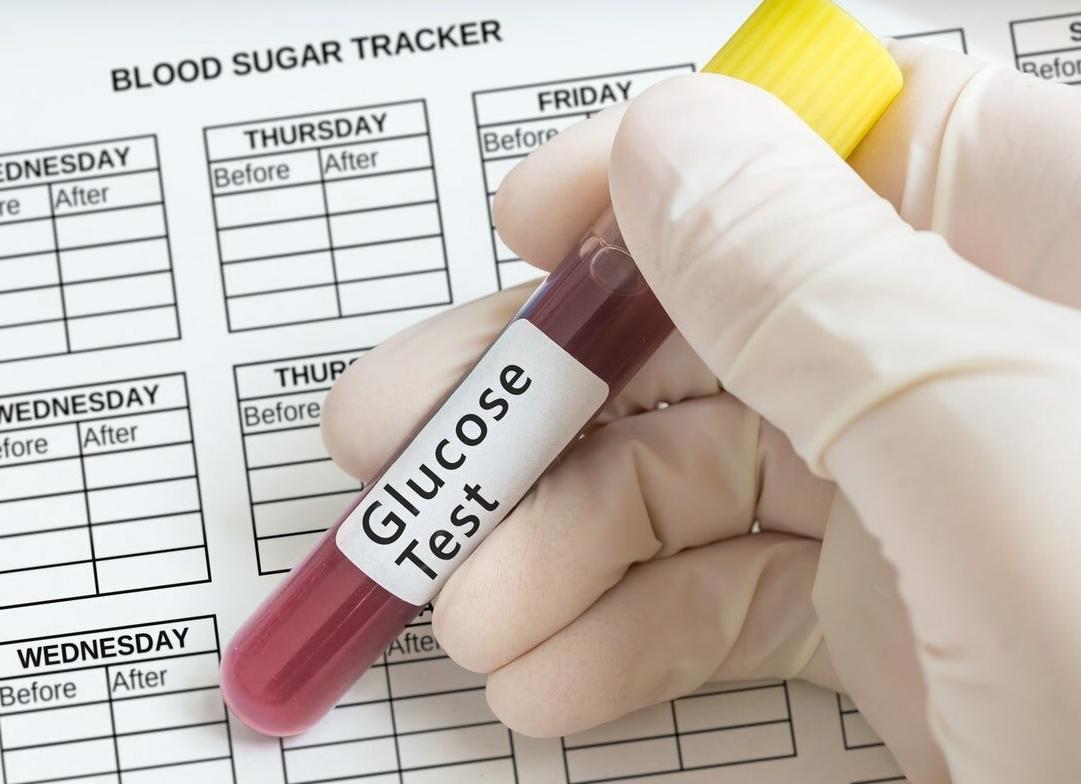 Глюкоза в анализе крови как обозначается