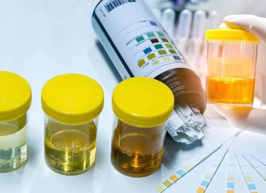 Что значит неполная прозрачность мочи