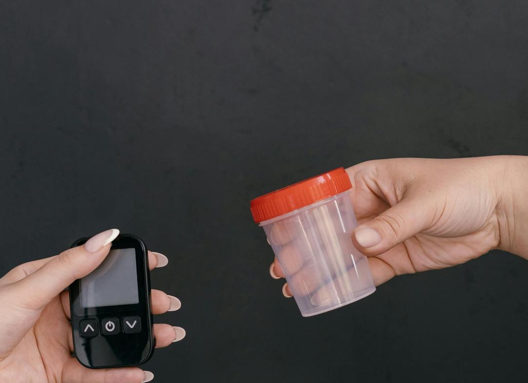 Что означает сахар в моче у мужчин