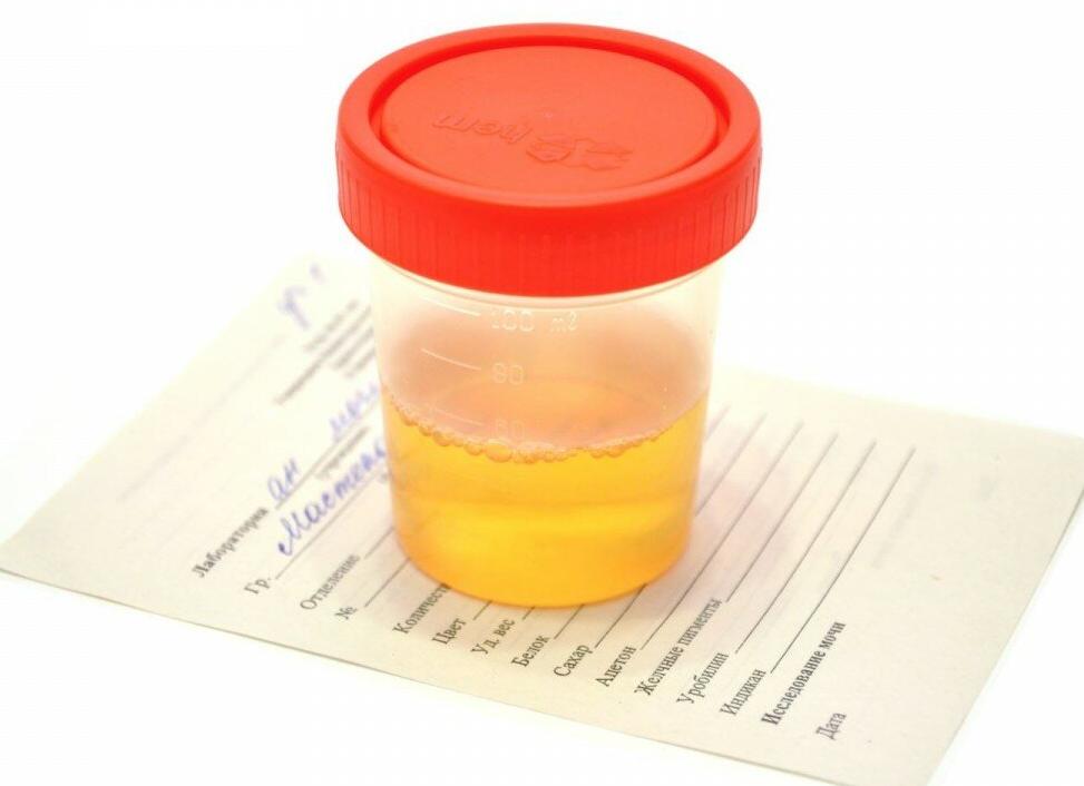 Анализ мочи по сулковичу как собирать у грудничка