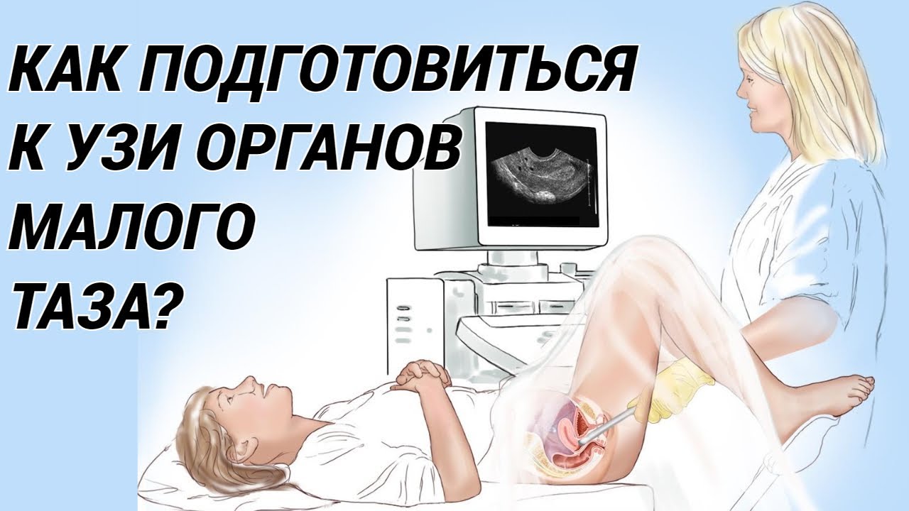 Как делают узи органов малого таза у женщин