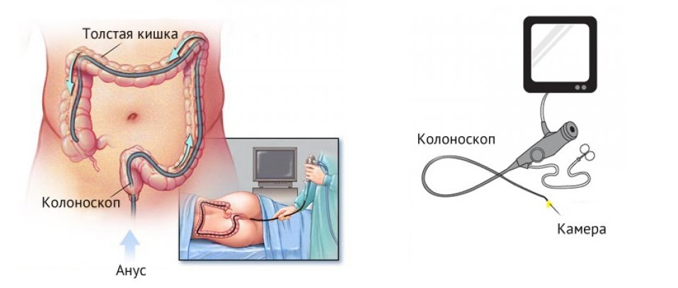 Как проводится узи кишечника