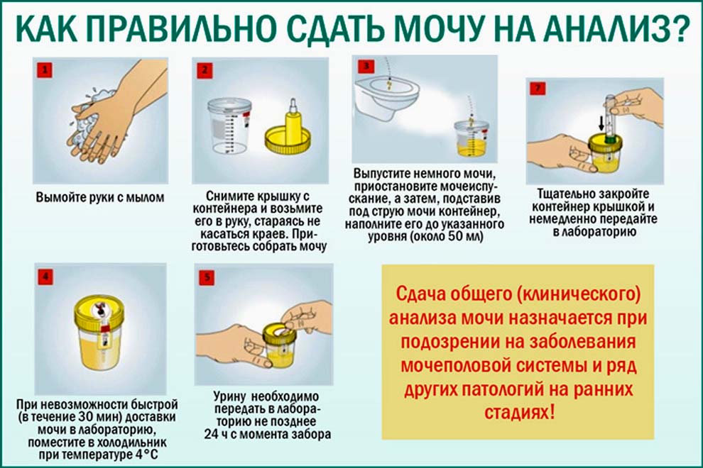Как сдать мочу