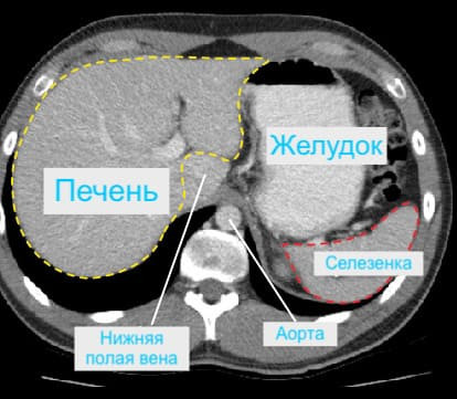 Кт желудка что показывает