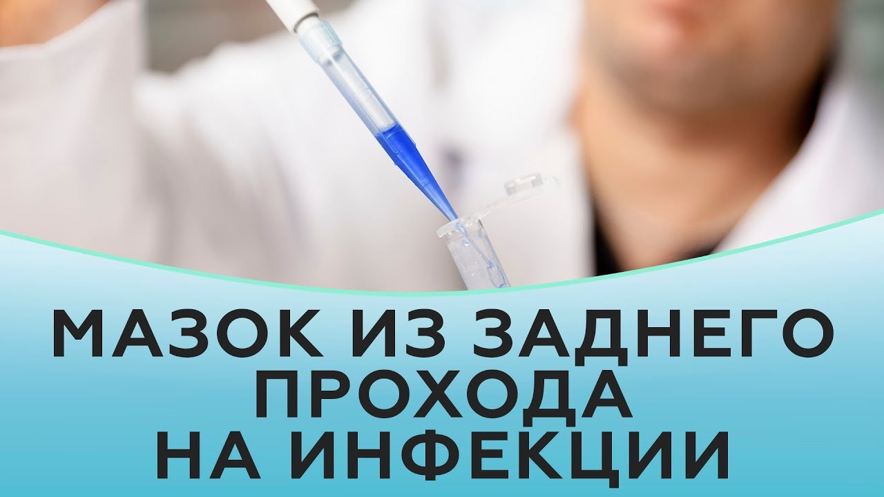 Мазок из заднего прохода