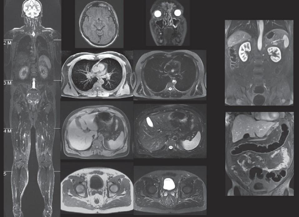 Мрт как влияет на организм человека