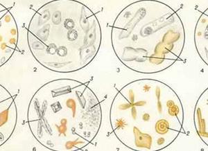 Моча с осадком