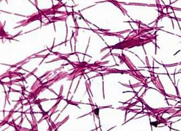 Лептотрихоз в гинекологии