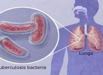 Какие заболевания у человека вызывают бактерии