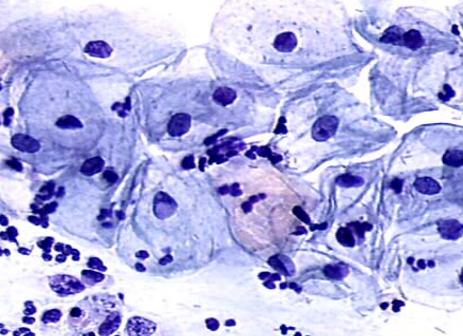 Гонококки в мазке что это